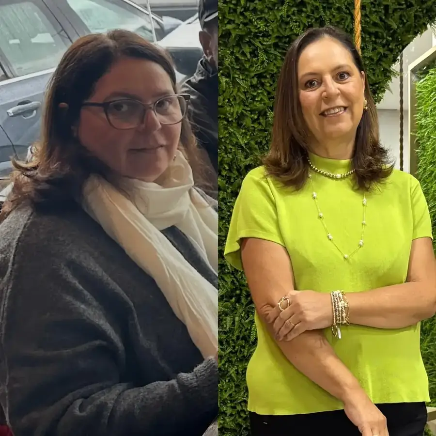 Antes e depois 1