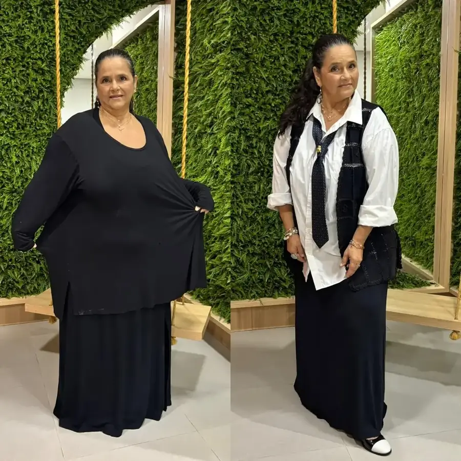 Antes e depois 2