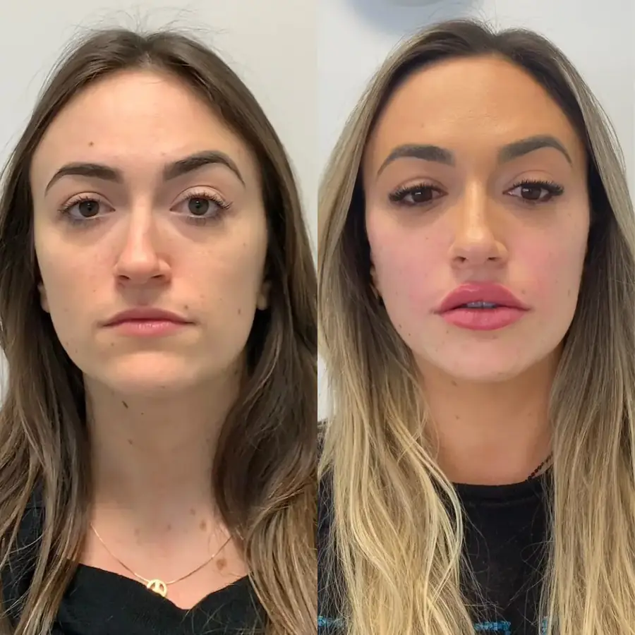Antes e depois 3