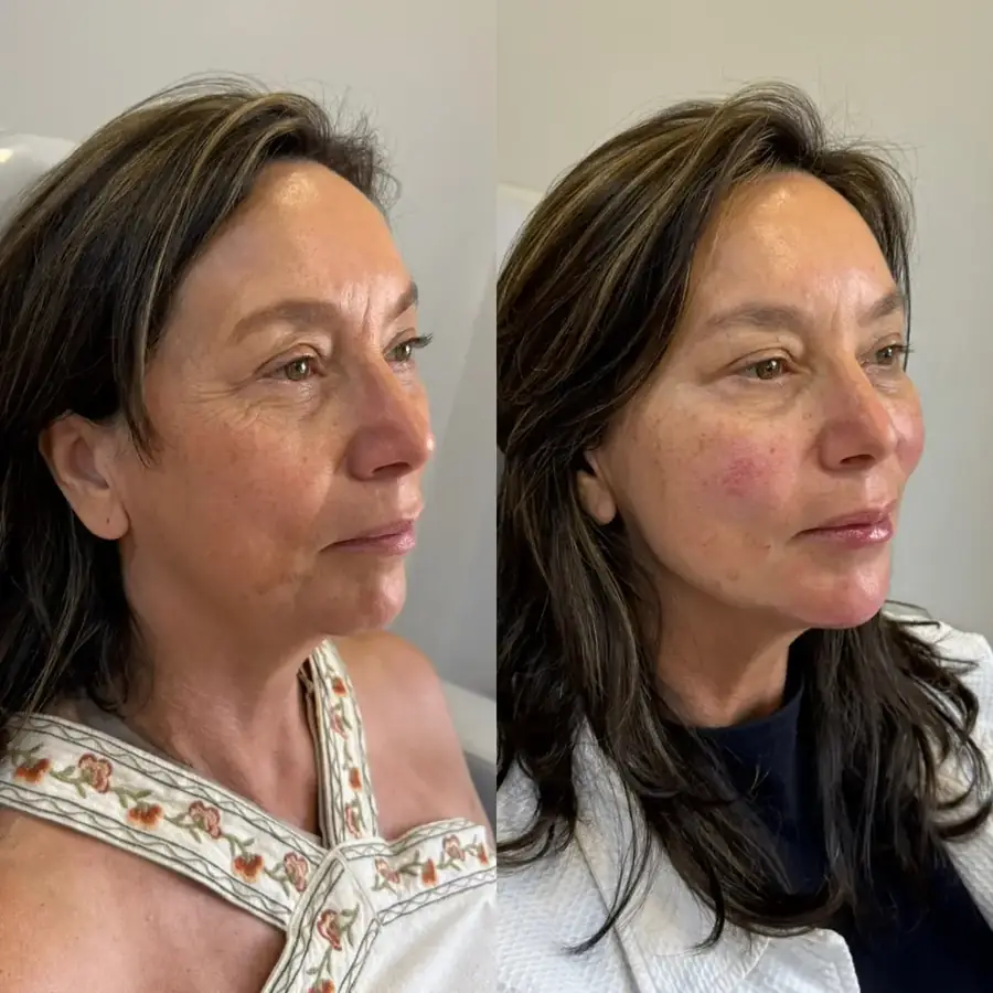 Antes e depois 6